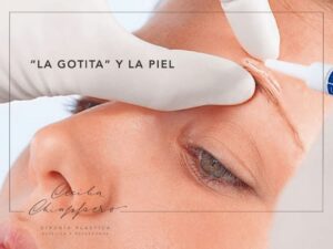 La Gotita y La Piel