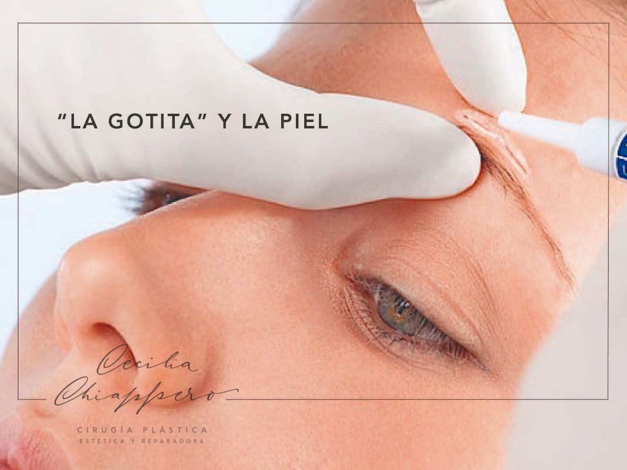 La Gotita y La Piel